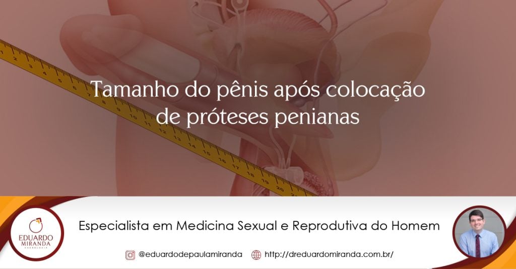 Dr. Eduardo Miranda – Página: 5 – Urologista especialista em Andrologia