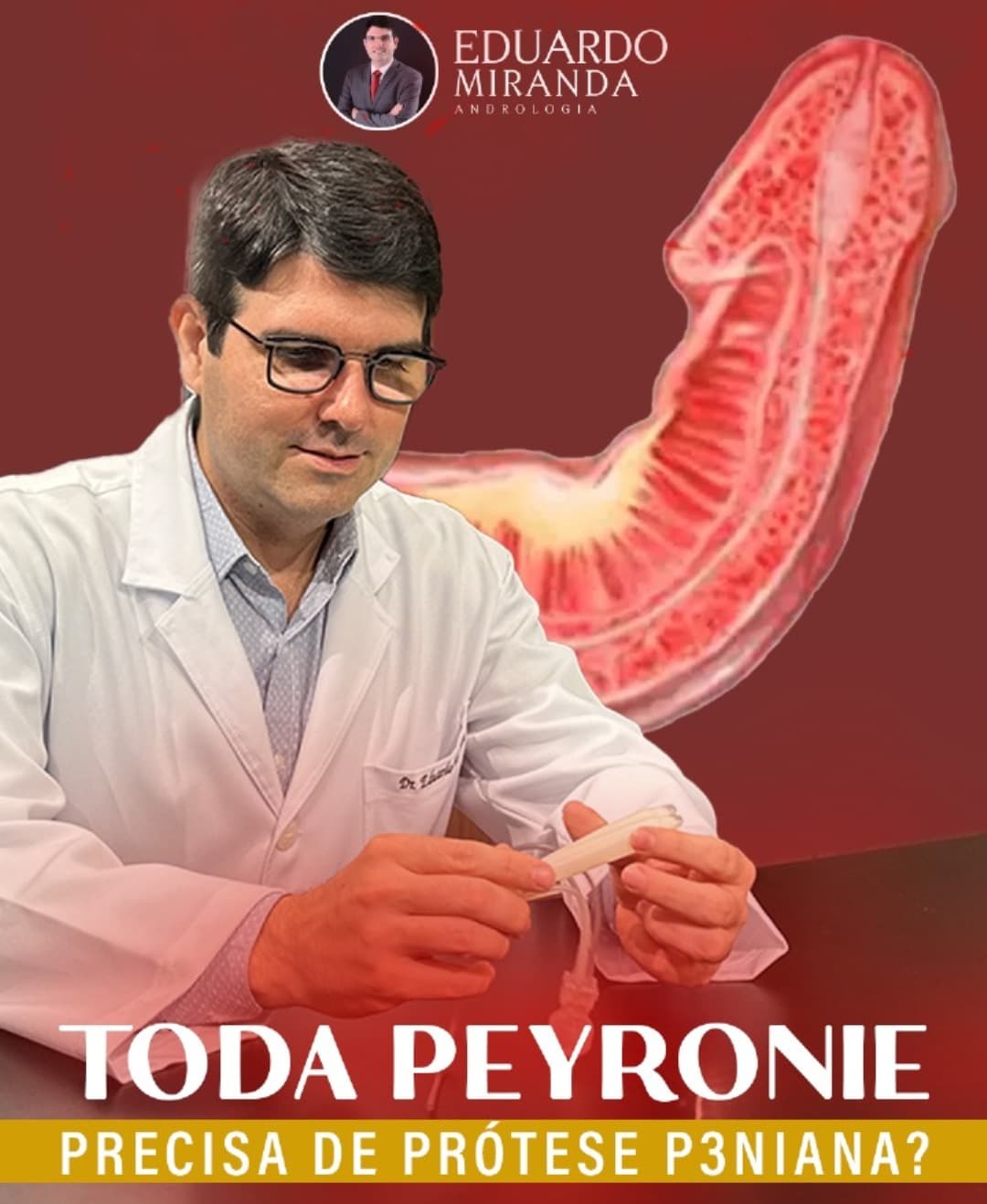 Toda Peyronie precisa de prótese peniana? - Dr. Eduardo Miranda